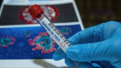 „Пирогов” ще прави PCR тестове за COVID-19 на пътуващи в чужбина