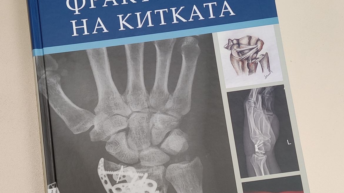 Доц. д-р Людмил Симеонов с авторска книга „Фрактурите на китката“